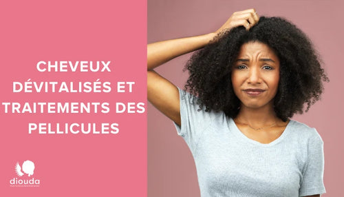 Cheveux dévitalisés et traitement des pellicules | Diouda