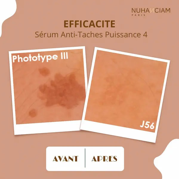 Très efficace, le Serum Anti-Taches Puissance 4 Nuhanciam est formulé avec un actif breveté, il fait disparaître et atténue les taches, unifie le teint et apporte de l’éclat.