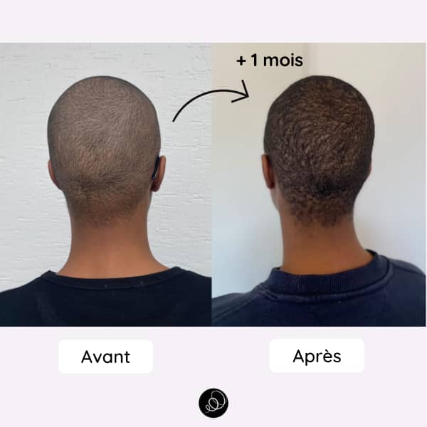 cure pousse cheveux afro résultat 1 mois cure de croissance active Curlista sur cheveux crépus