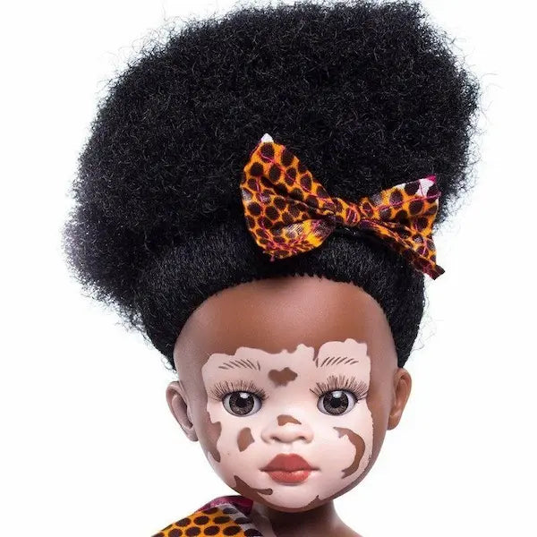 Poupée noire au vitiligo Ndanaka | Sibahle Collection