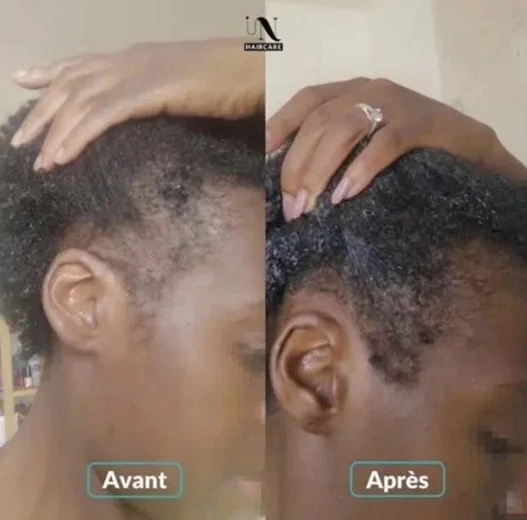 In Hair care Avant/après Gélules Pousse Cheveux Cure de 3 mois