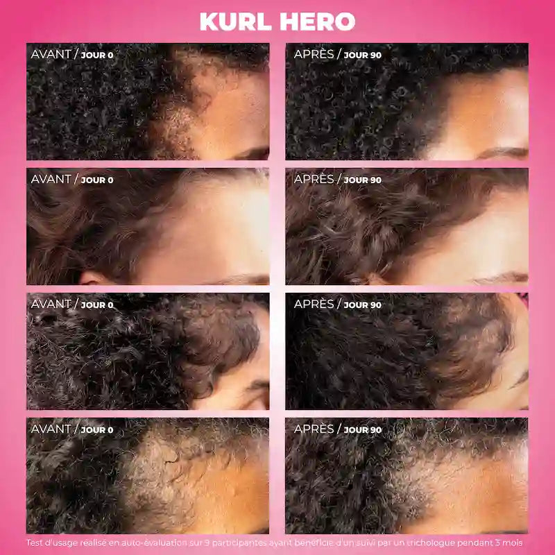 Avant Après 90 jours de cure sur cheveux crépus, frisés, bouclés, ondulés avec Kurl Hero Les Secrets de Loly