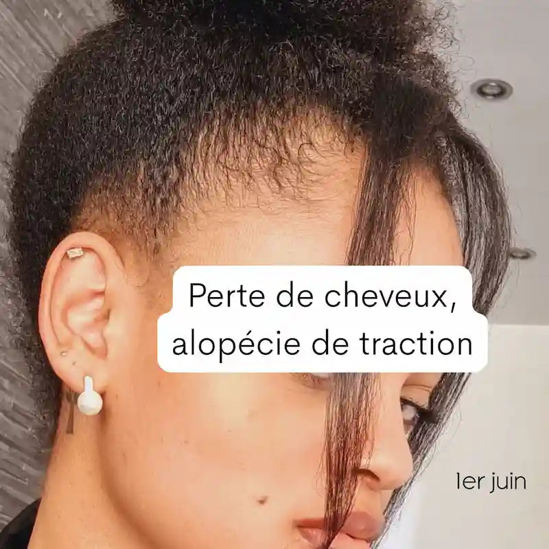 Avant l'utilisation du Sérum anti-chute Cheveux Chebhair Efficace sur l'alopécie de traction