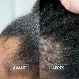 Avant Après In Haircare Sérum boost & scalp